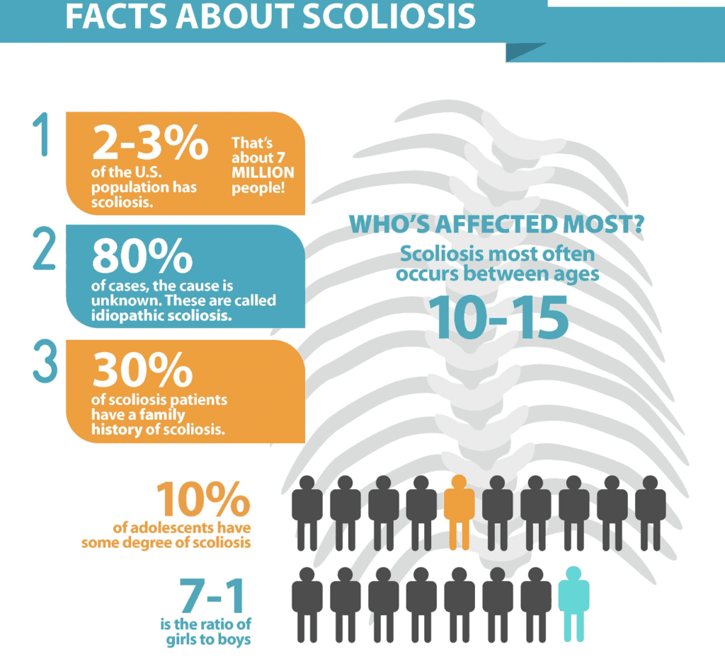 Facts-About-Scoliosis-Who-is-Affected-Most
